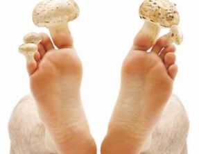 comment traiter les champignons sur les ongles des pieds